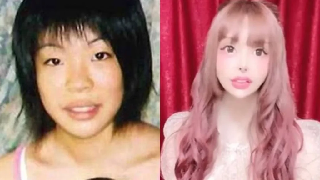 Plastic Surgery in Japan: How It Compares to Korea’s Beauty Culture 2 Plastic Surgery Japanese Influencer
